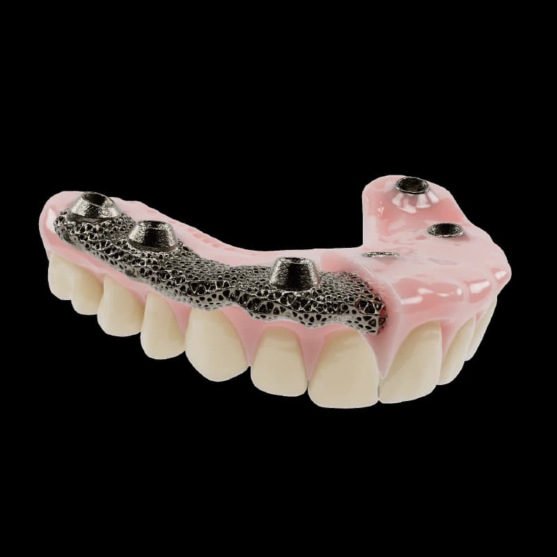 AvaMax Fixed Hybrid monolithic digital denture