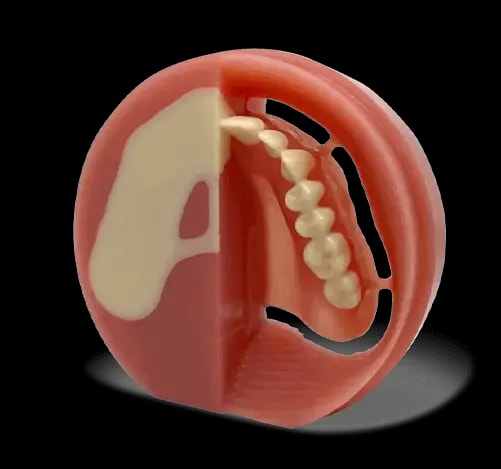 Cross-section of AvaDent's monolithic denture puck showing one-piece construction